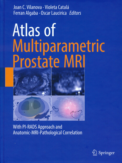 Atlas of multiparametric prostate MRI : with PI-RADS approach and anatomic-MRI-pathological correlation