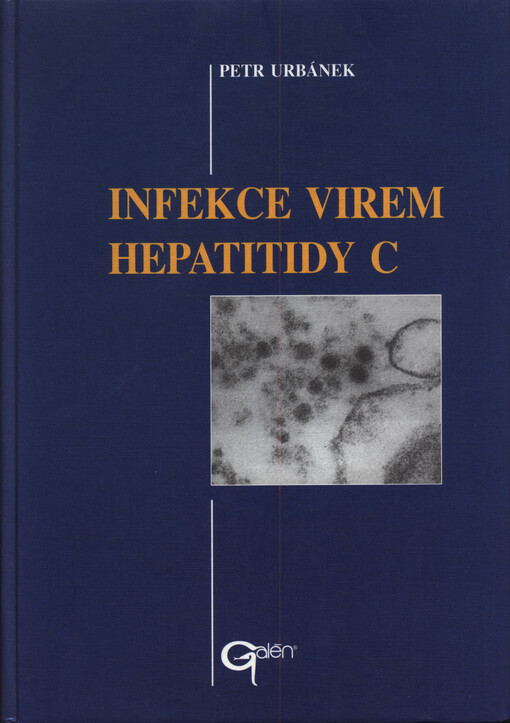 Infekce virem hepatitidy C