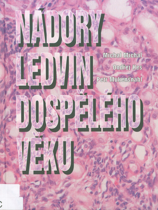 Nádory ledvin dospělého věku