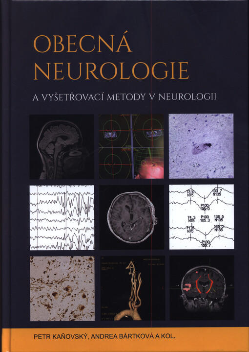 Obecná neurologie a vyšetřovací metody v neurologii