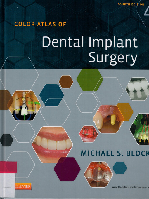 Color atlas of dental implant surgery