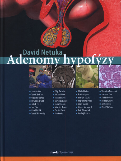 Adenomy hypofýzy : diagnostika a kompletní léčba
