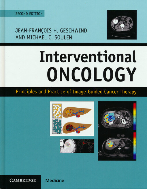 Interventional oncology : principles and practice of image-guided cancer therapy