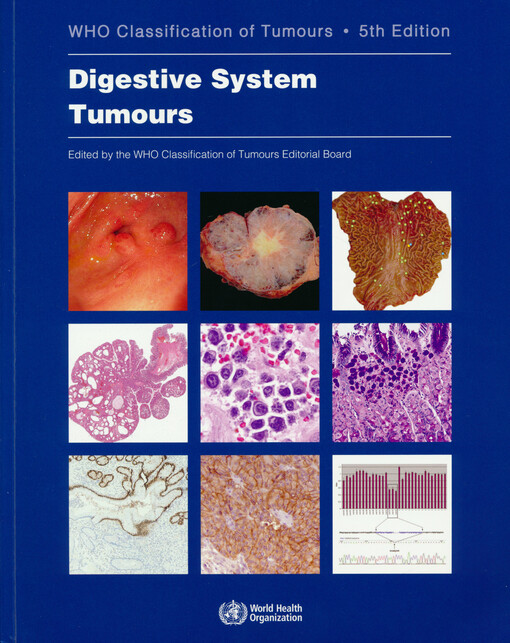 Digestive system tumours