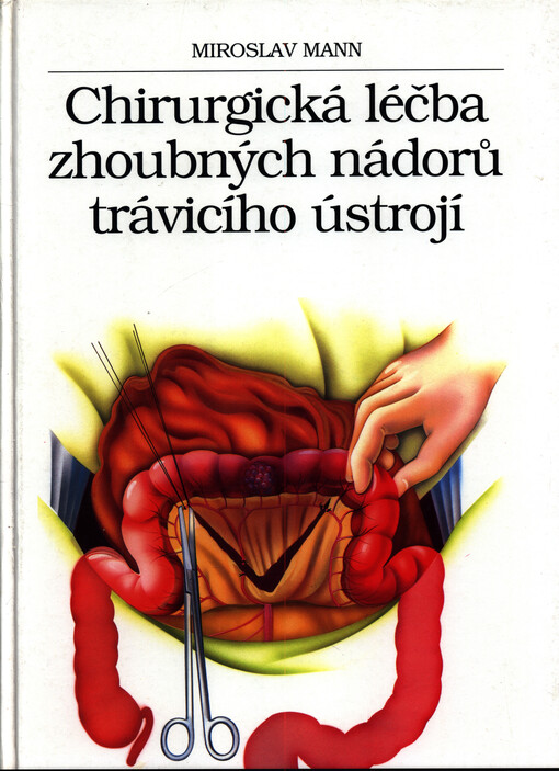 Chirurgická léčba zhoubných nádorů trávicího ústrojí