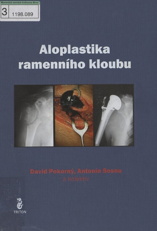 Aloplastika ramenního kloubu