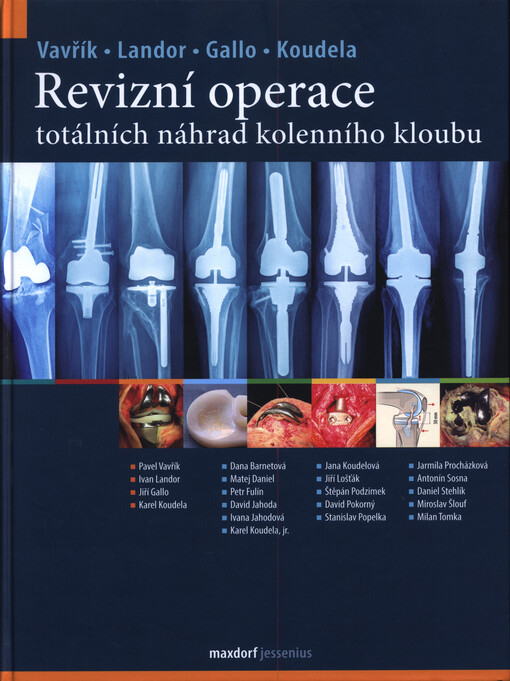 Revizní operace totálních náhrad kolenního kloubu