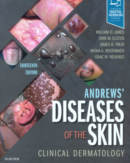 Andrews' diseases of the skin : clinical dermatology