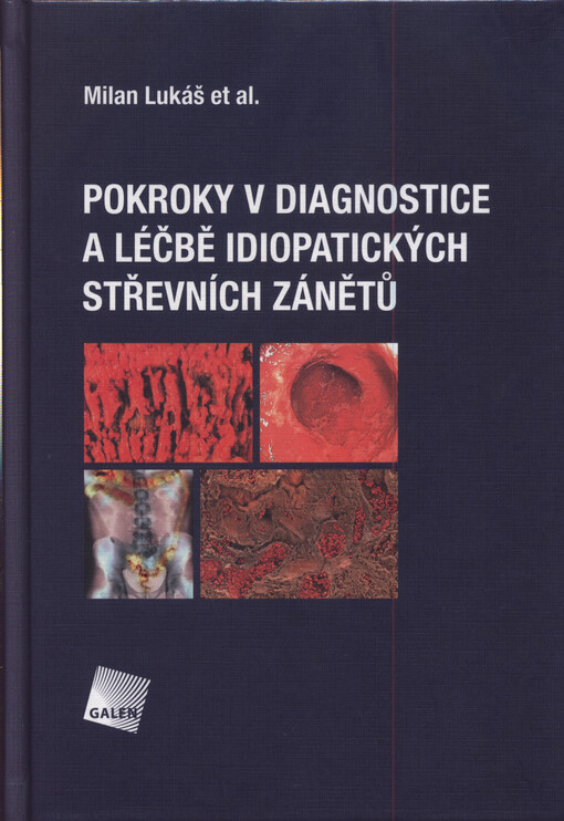 Pokroky v diagnostice a léčbě idiopatických zánětů