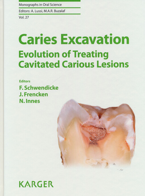 Caries excavation : evolution of treating cavitated carious lesions