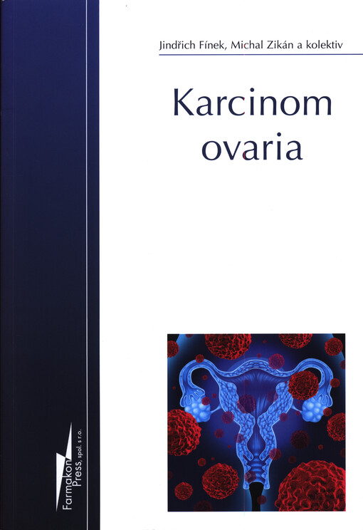 Karcinom ovaria
