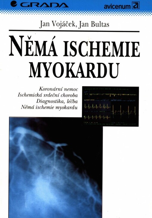 Němá ischemie myokardu