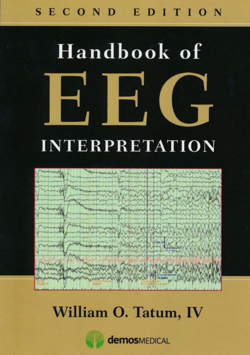 Handbook of EEG interpretation
