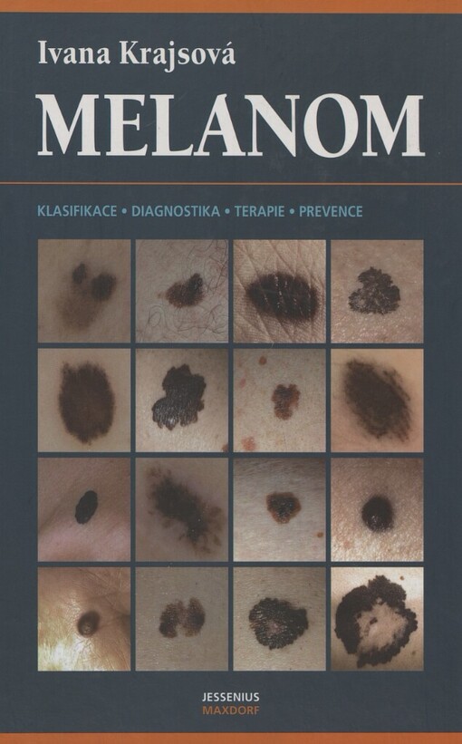Melanom: [klasifikace, diagnostika, terapie, prevence]
