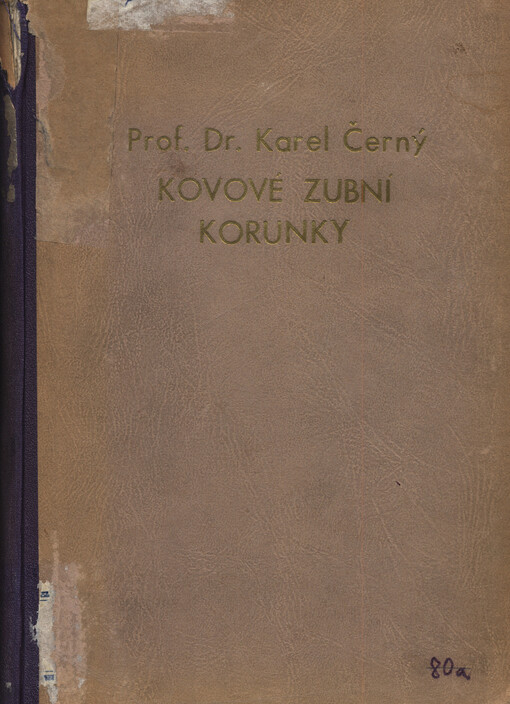 Kovové zubní korunky