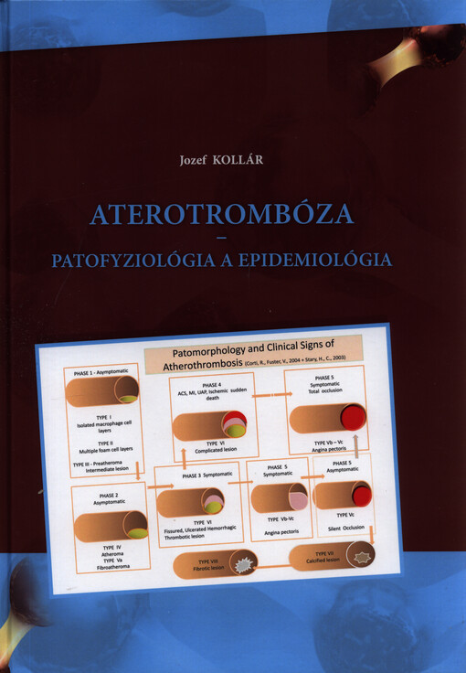 Aterotrombóza : patofyziológia a epidemiológia