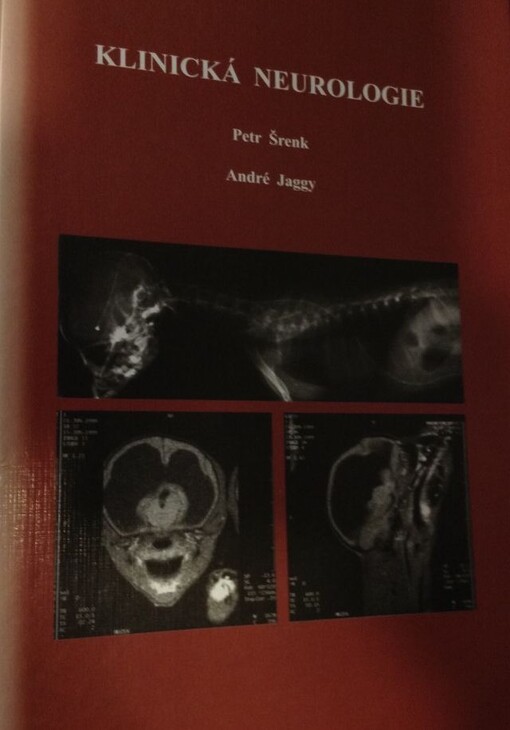 Klinická neurologie
