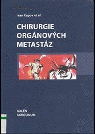 Chirurgie orgánových metastáz