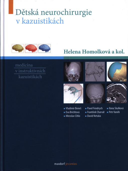 Dětská neurochirurgie v kazuistikách