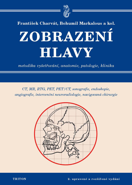 Zobrazení hlavy: metodika vyšetřování, anatomie, patologie, klinika : CT, MR, RTG, PET, PET/CT, sonografie, endoskopie, angiografie, intervenční neuroradiologie, navigovaná chirurgie