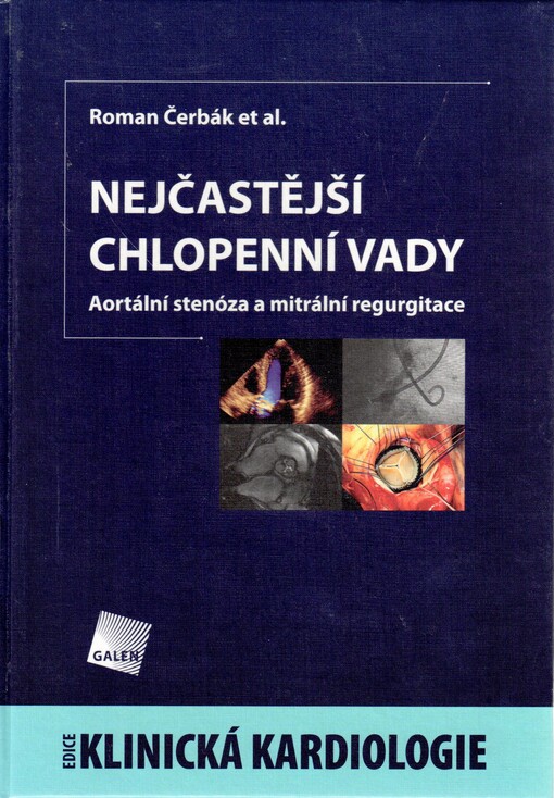 Nejčastější chlopenní vady: aortální stenóza a mitrální regurgitace