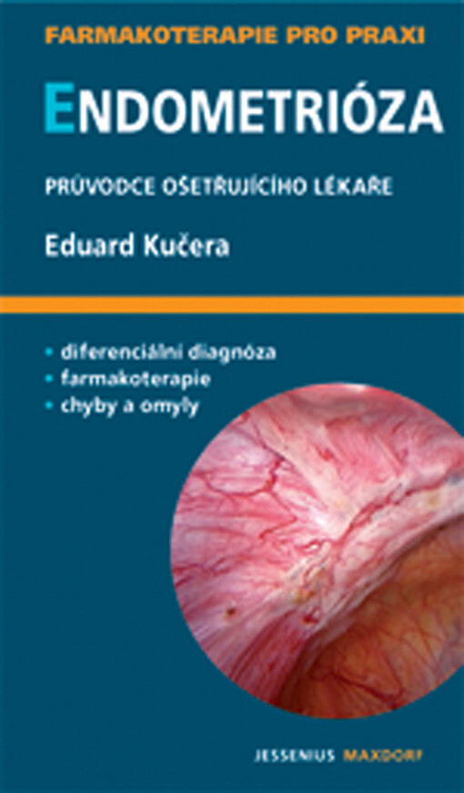 Endometrióza : průvodce ošetřujícího lékaře