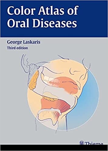 Color atlas of oral diseases