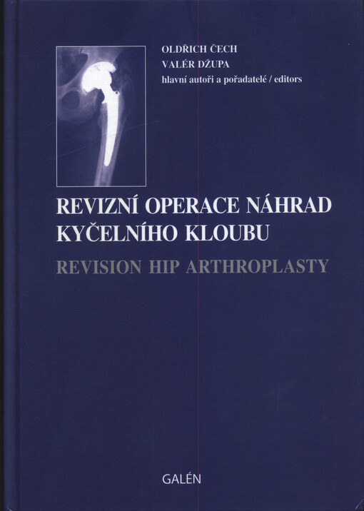 Revizní operace náhrad kyčelního kloubu = Revision hip arthroplasty