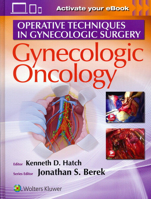 Gynecologic oncology