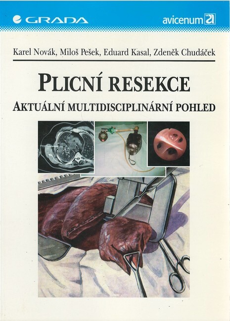 Plicní resekce : aktuální multidisciplinární pohled