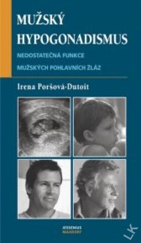 Mužský hypogonadismus : nedostatečná funkce mužských pohlavních žláz
