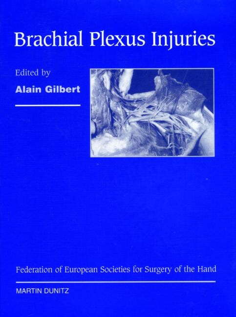 Brachial plexus injuries