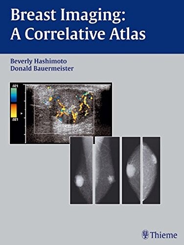 Breast imaging : a correlative atlas