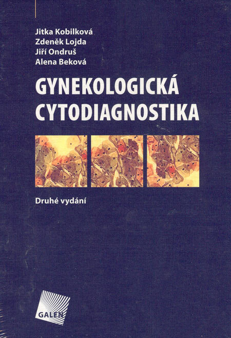 Gynekologická cytodiagnostika