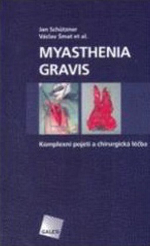 Myasthenia gravis : komplexní pojetí a chirurgická léčba