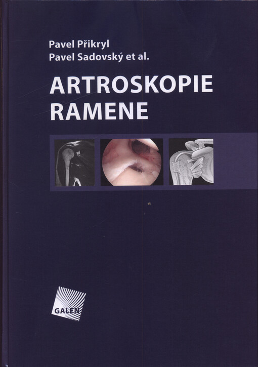 Artroskopie ramene