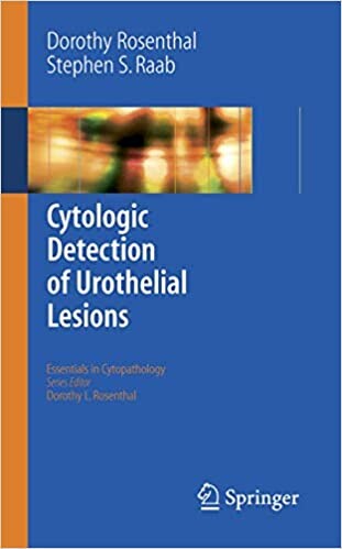 Cytologic detection of urothelial lesions