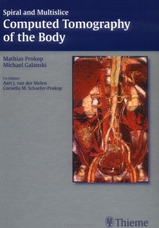 Spiral and multislice computed tomography of the body