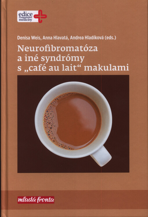 Neurofibromatóza a iné syndrómy s 