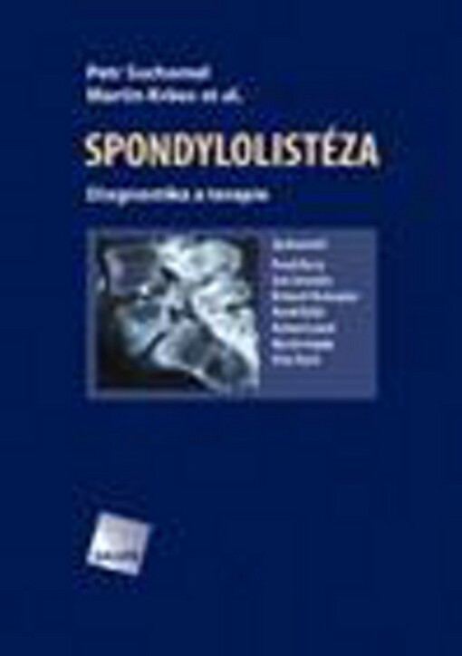 Spondylolistéza: diagnostika a terapie