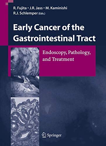 Early Cancer of the Gastrointestinal Tract: Endoscopy, Pathology, and Treatment