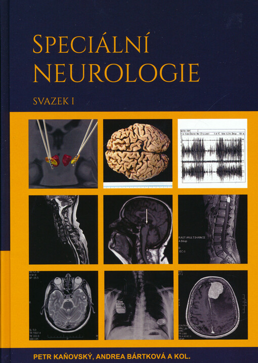 Speciální neurologie. Svazek II