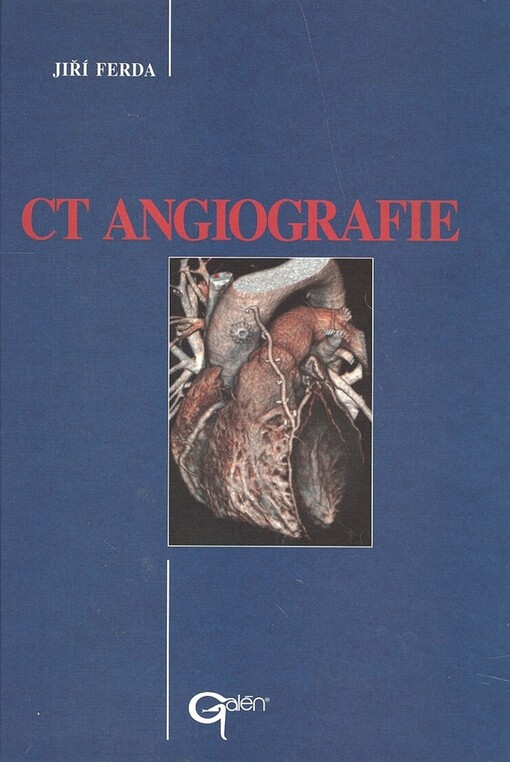 CT angiografie