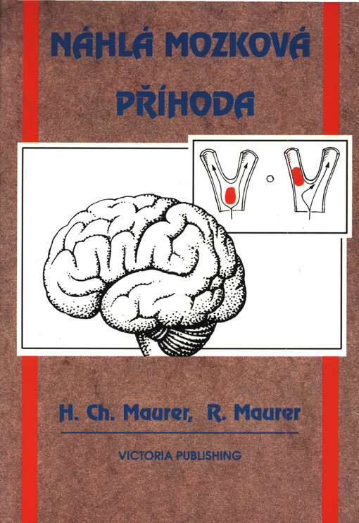 Náhlá mozková příhoda