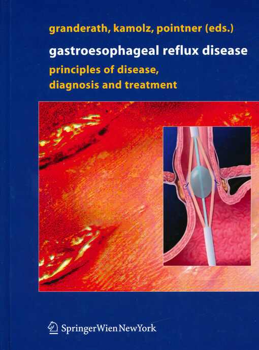 Gastroesophageal reflux disease : principles of disease, diagnosis, and treatment