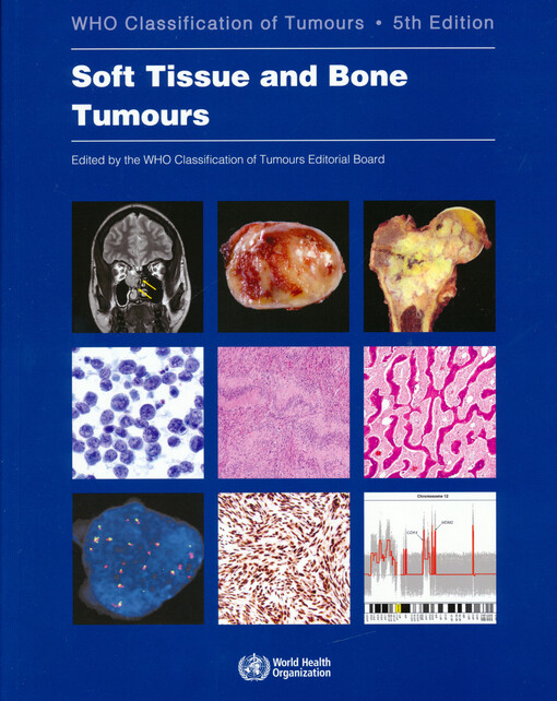 Soft tissue and bone tumours