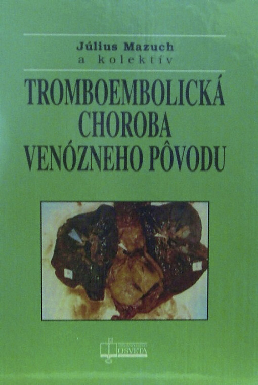 Tromboembolická choroba venózneho pôvodu : 1. slovenské vydanie