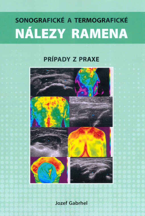 Sonografické a termografické nálezy ramena : prípady z praxe