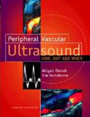 Peripheral vascular ultrasound : how, why and when