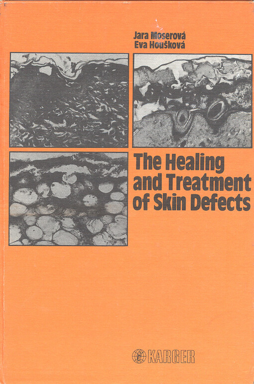 The healing and treatment of skin defects